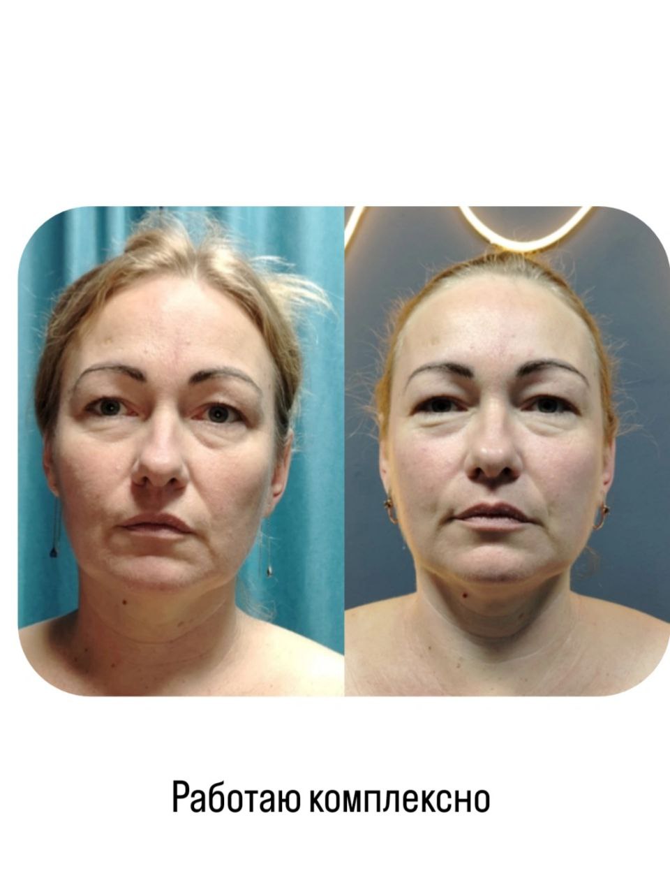 Массаж лица с эффектом лифтинга - Красота и здоровье в Краснодар