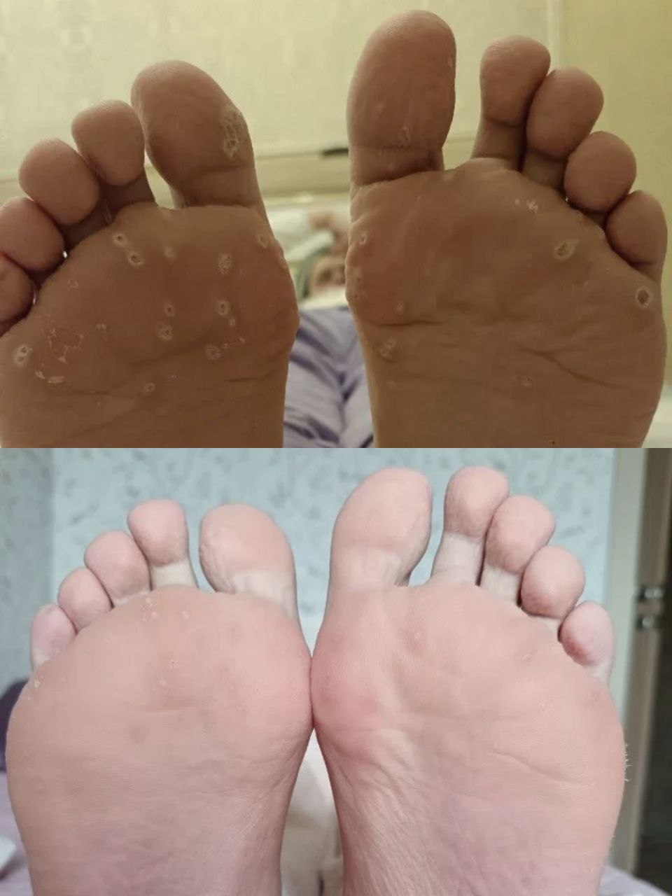 Мазь от шипиц, папиллом и грибка ногтей - Красота и здоровье в Москва