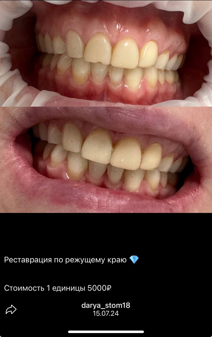 Услуги стоматолога в Балашихе - частное объявление в Балашиха