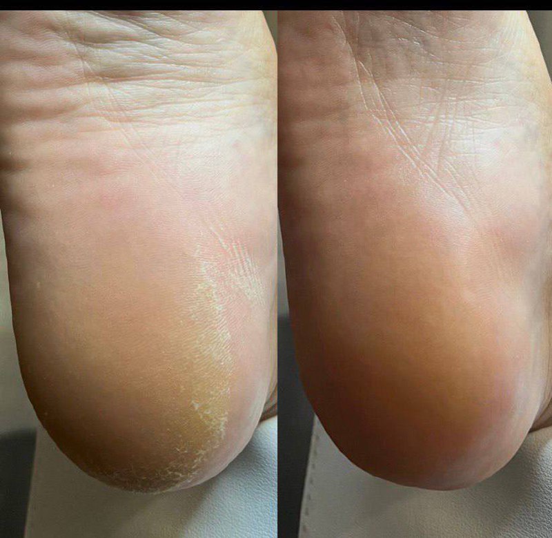 Smart педикюр и Smarticur - частное объявление в Новороссийск