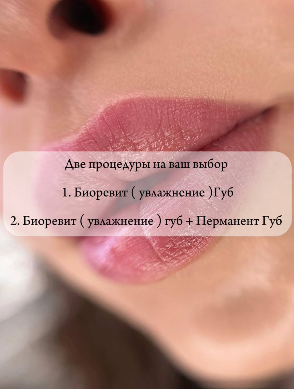 Процедура для супер увлажнения губ - частное объявление в Новороссийск