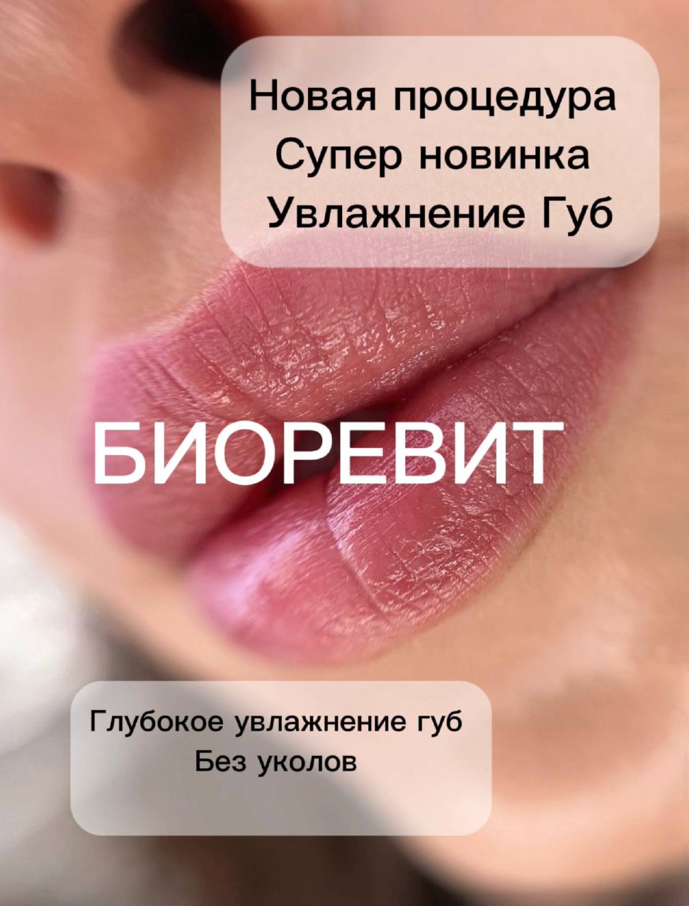 Процедура для супер увлажнения губ - Красота и здоровье в Новороссийск - фото 3