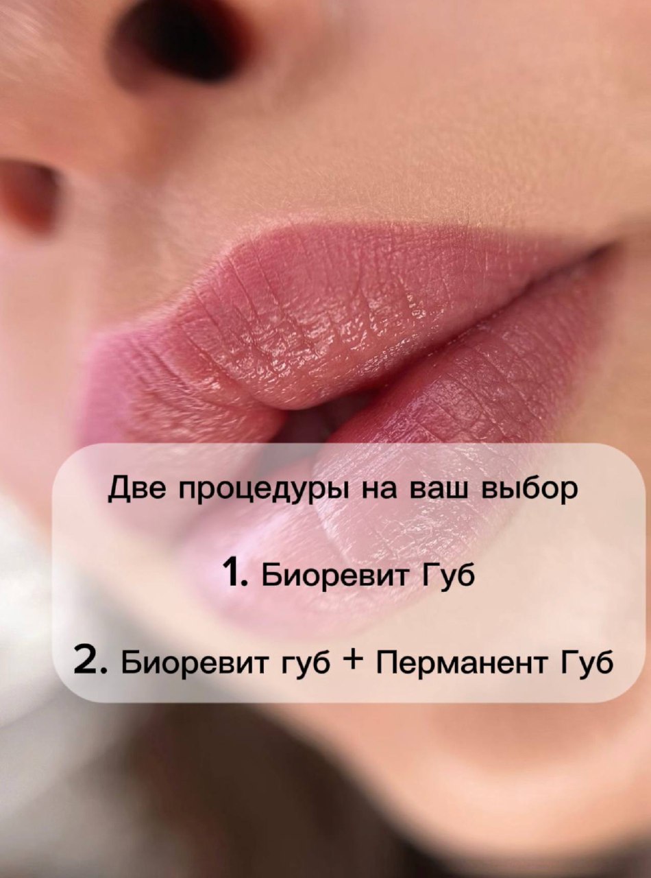Процедура глубокого увлажнения губ Biorevit - Красота и здоровье в Новороссийск - фото 4