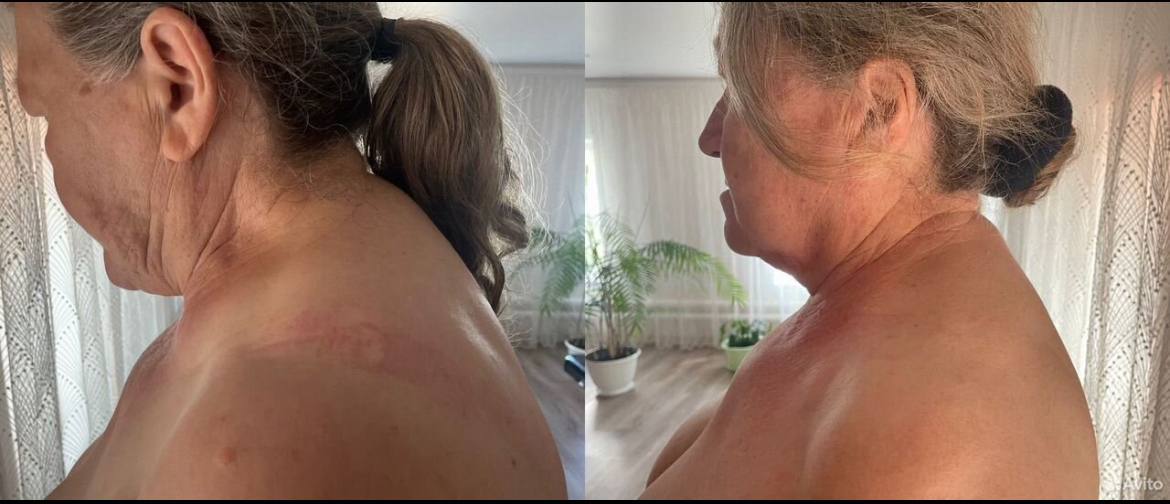 Фасциальный массаж лица и тела - Услуги в Тольятти - фото 3