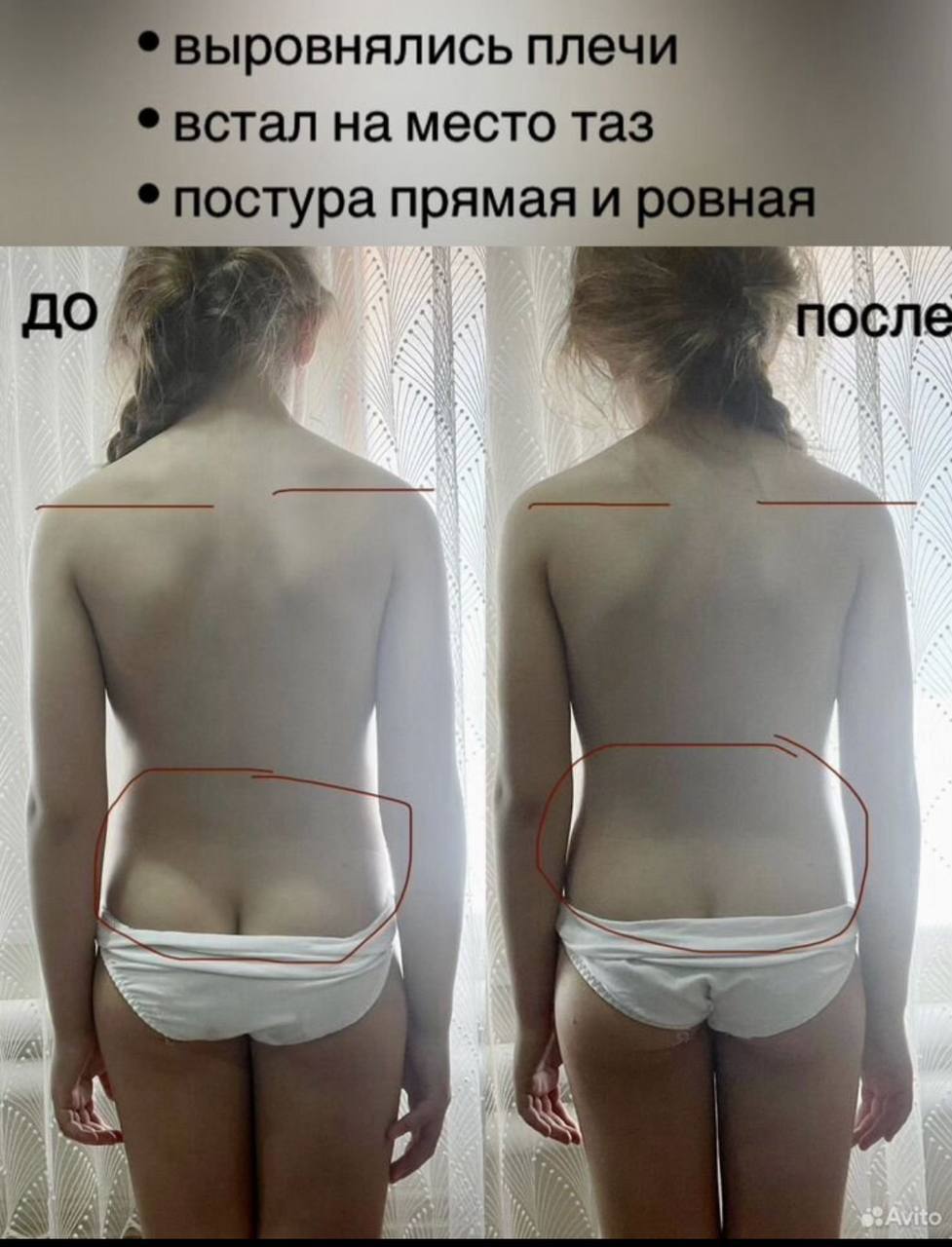 Фасциальный массаж лица и тела - Услуги в Тольятти - фото 4