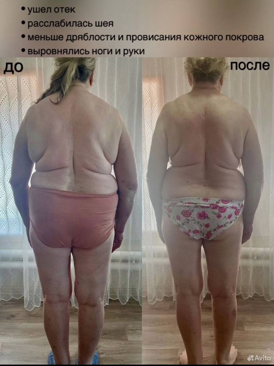 Фасциальный массаж лица и тела - Услуги в Тольятти - фото 5