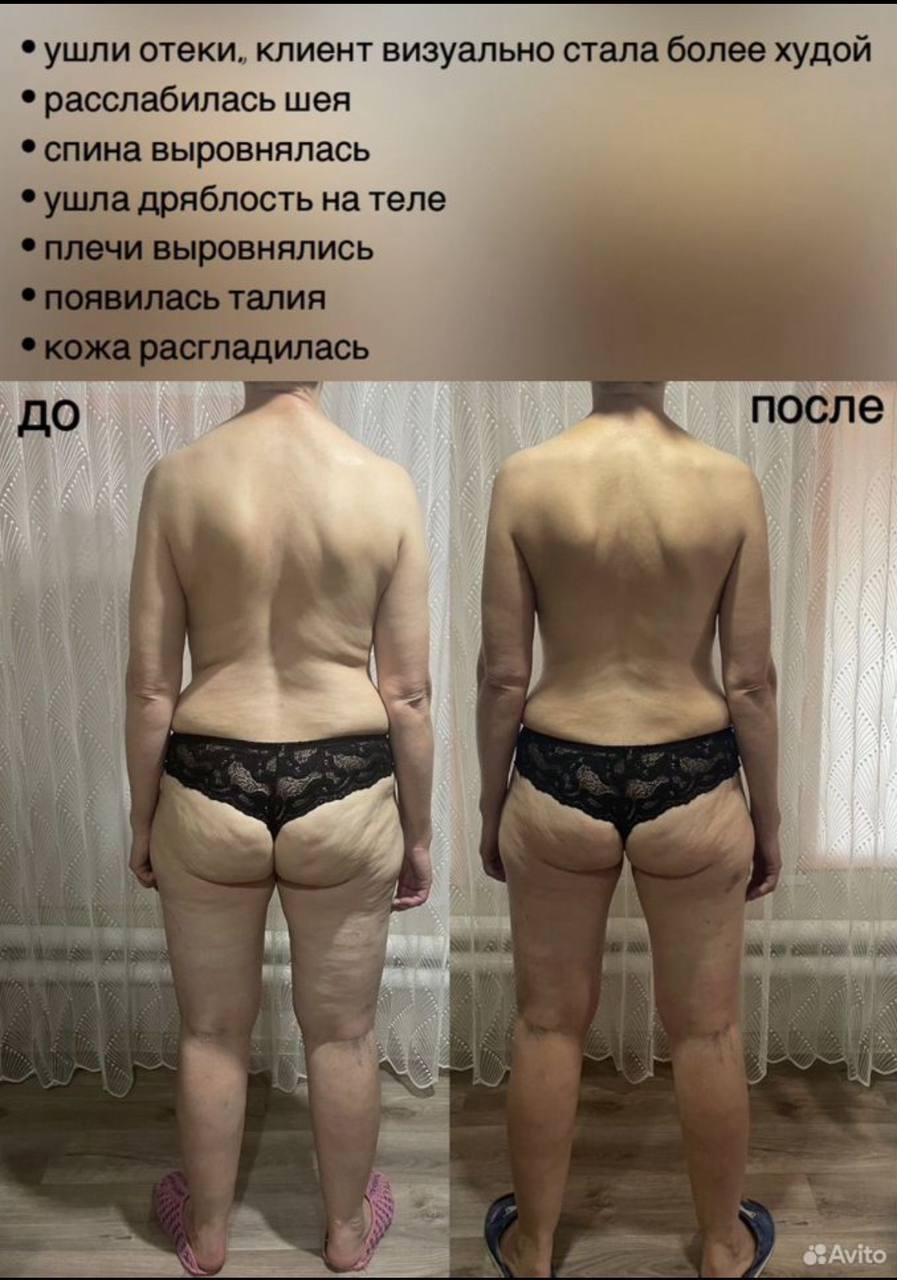 Фасциальный массаж лица и тела - Услуги в Тольятти - фото 6