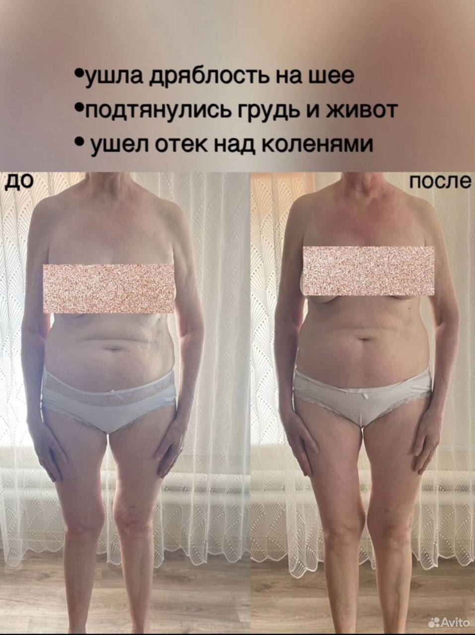 Фасциальный массаж лица и тела - Услуги в Тольятти - фото 7