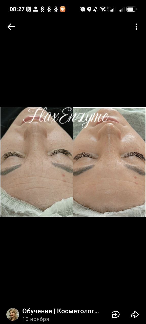 Отработка новой техники восстановления и омоложения кожи - Красота и здоровье в Новороссийск