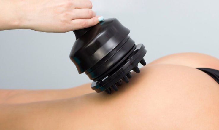 Комплексная процедура коррекции фигуры - частное объявление в Балашиха