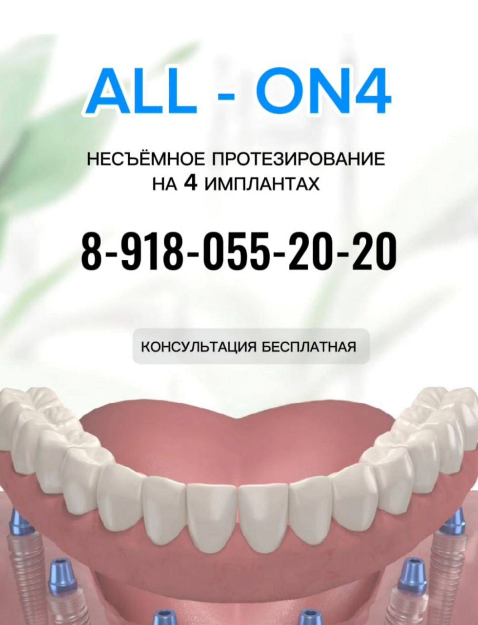 Имплантация All-on-4 - Услуги в Новороссийск