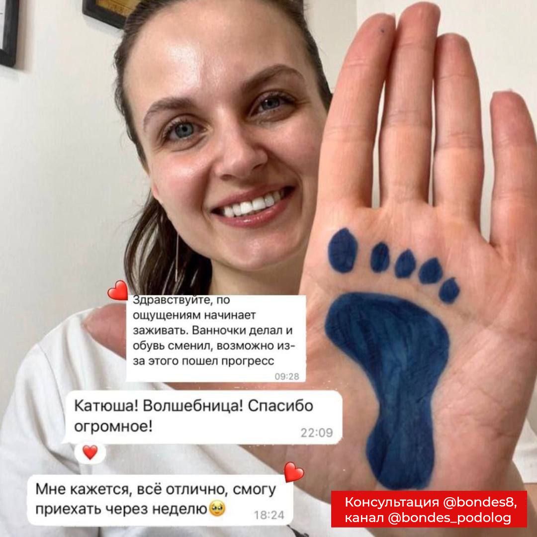 Консультация подолога Екатерины Бондаренко - частное объявление в Москва