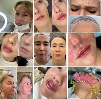 Косметолог с 18-летним стажем - частное объявление в Москва