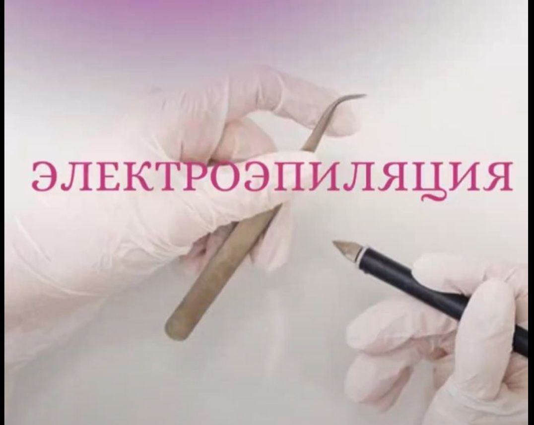 Электроэпиляция и косметические процедуры - Красота и здоровье в Саратов