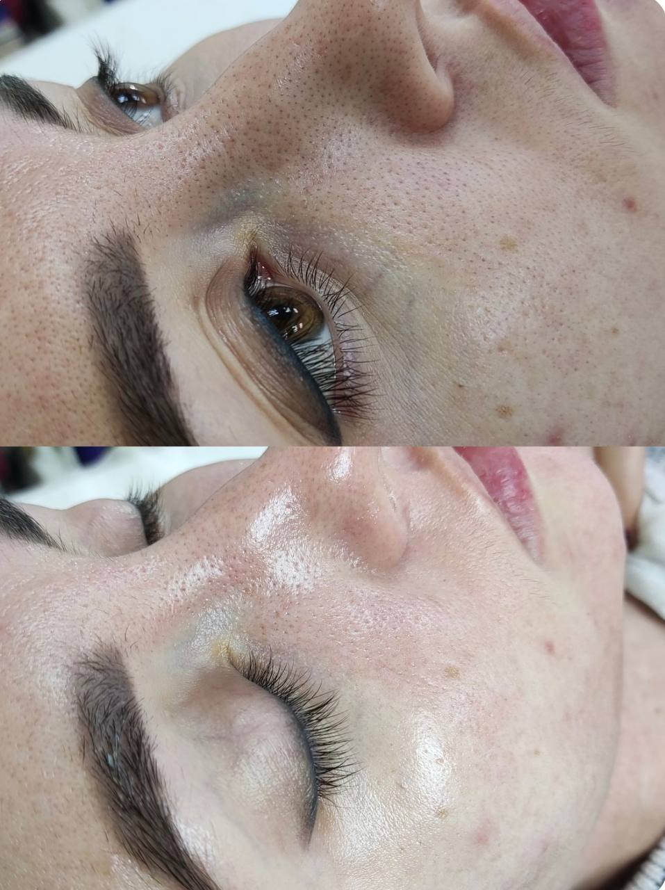 Косметологические процедуры - частное объявление в Казань