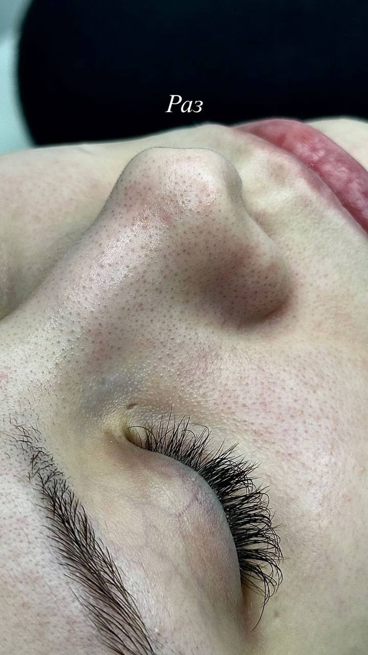 Косметологические процедуры - Красота и здоровье в Казань - фото 4