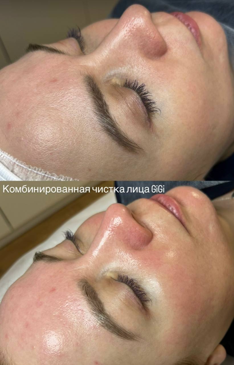 Косметологические процедуры - частное объявление в Казань