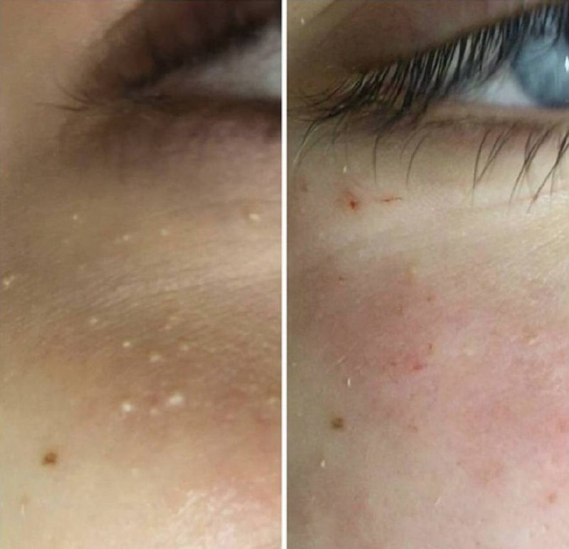 Набор моделей в студию Luxe beauty - частное объявление в Казань