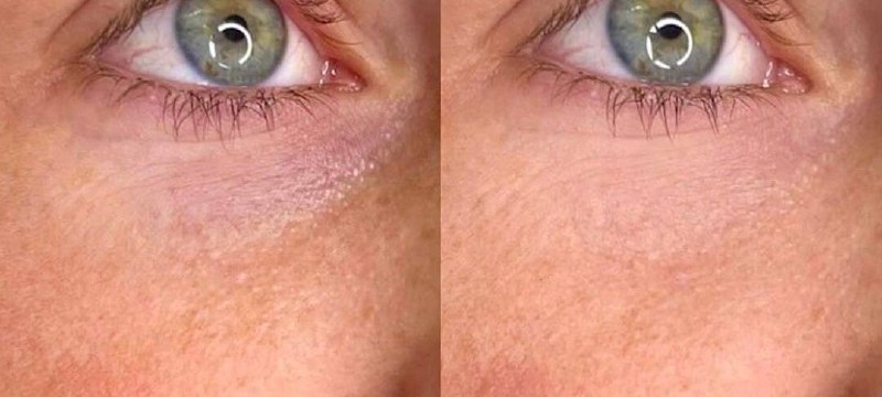 Услуги косметолога - Красота и здоровье в Екатеринбург