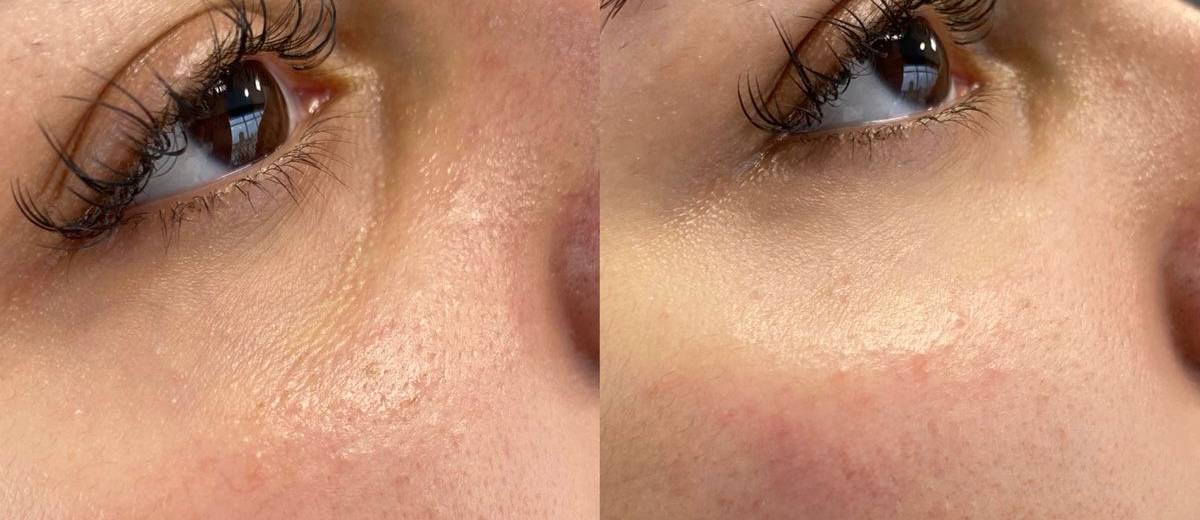 Услуги косметолога - Красота и здоровье в Екатеринбург - фото 2