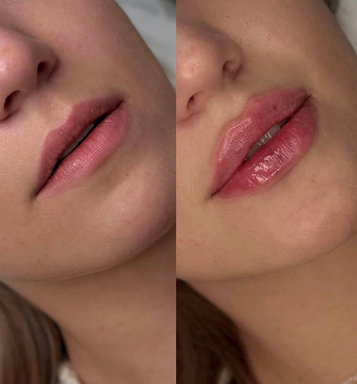 Услуги косметолога - Красота и здоровье в Екатеринбург - фото 5