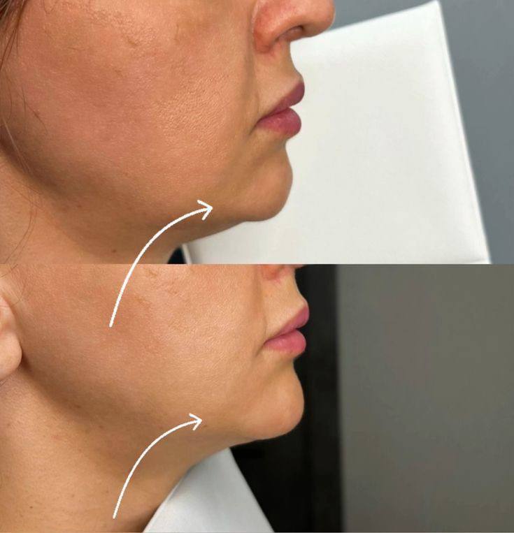 Услуги косметолога для моделей - Услуги в Екатеринбург - фото 4