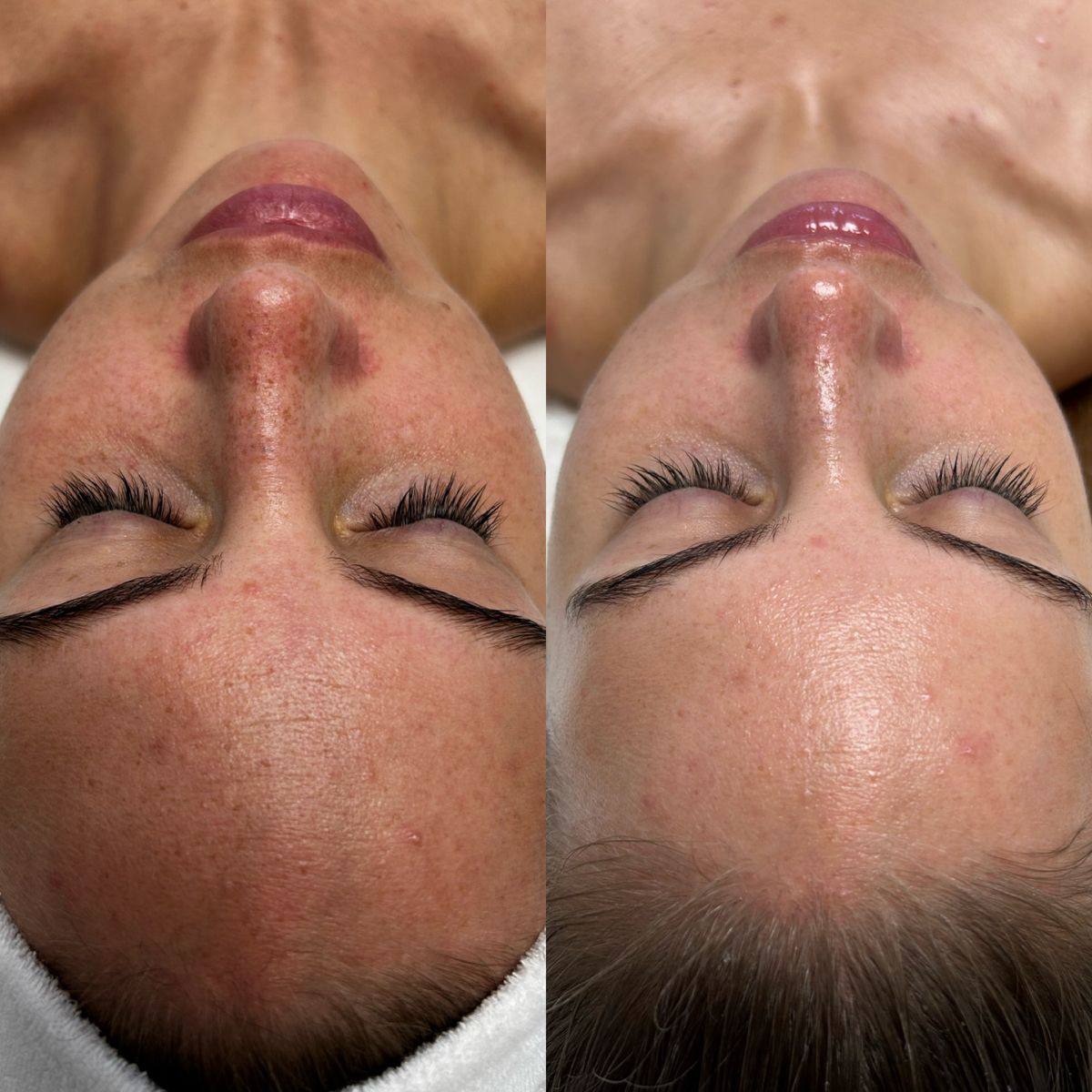 Услуги косметолога для моделей - Услуги в Екатеринбург - фото 5