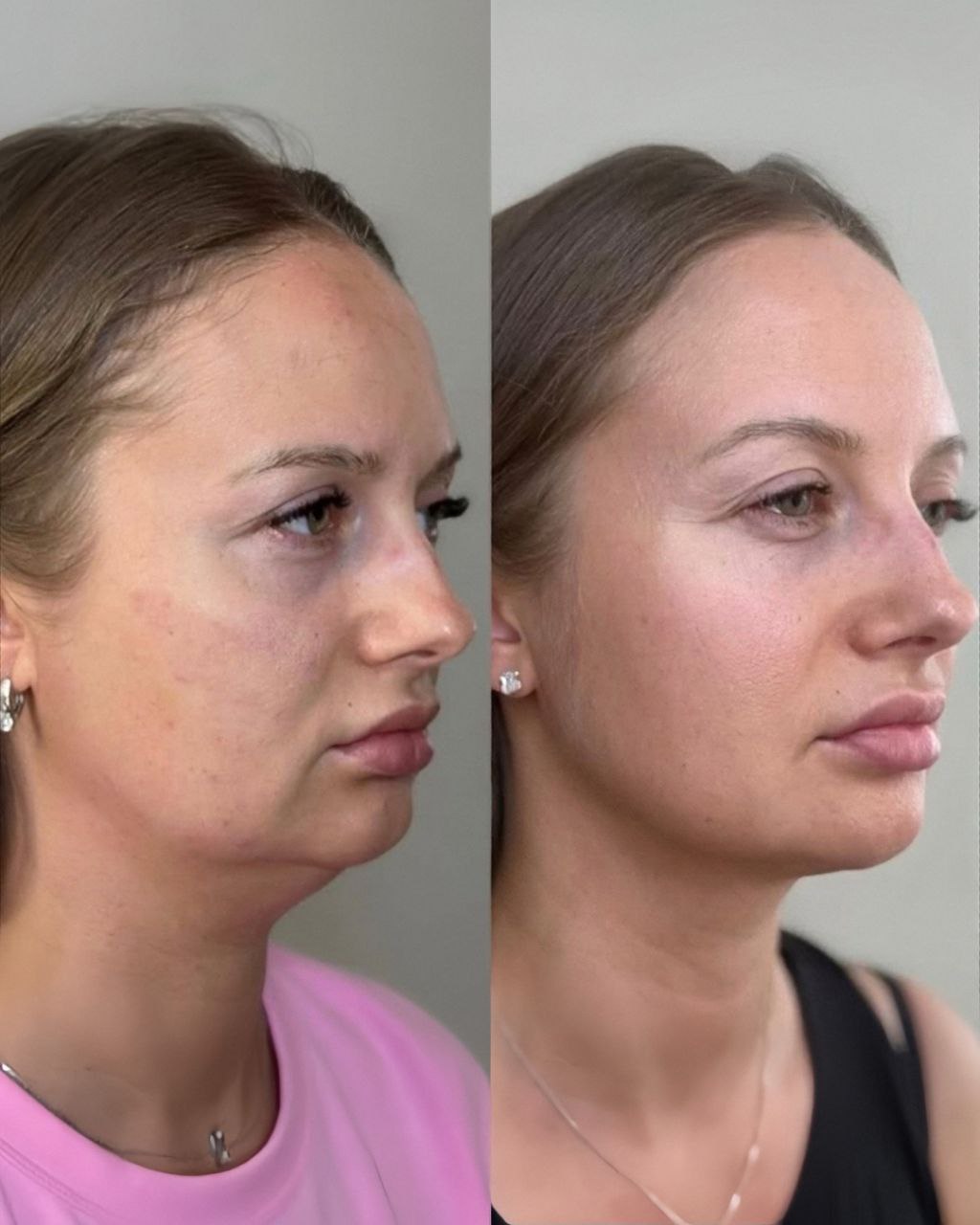 Косметолог Елена Торопова Омск - Красота и здоровье в Омск - фото 3