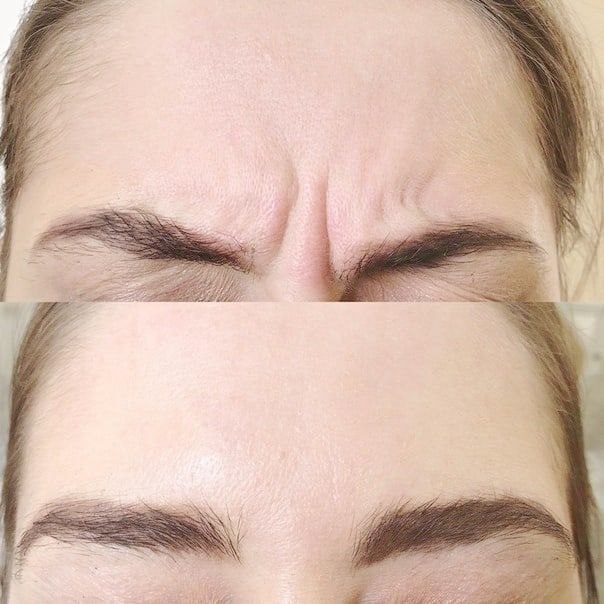 Косметолог Елена Торопова Омск - Красота и здоровье в Омск - фото 4