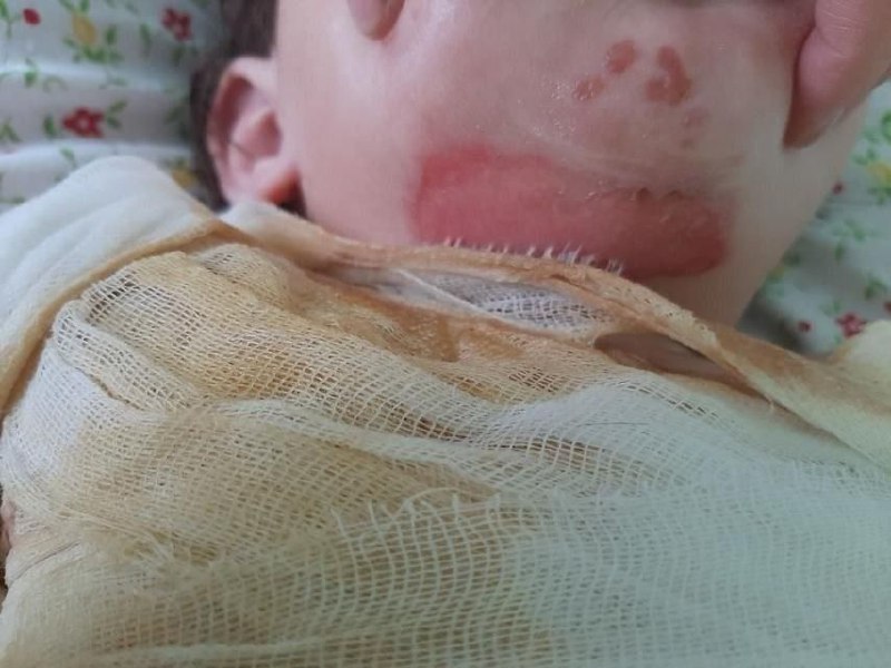 Сбор средств на лечение дочери после обстрела - частное объявление в Воронеж