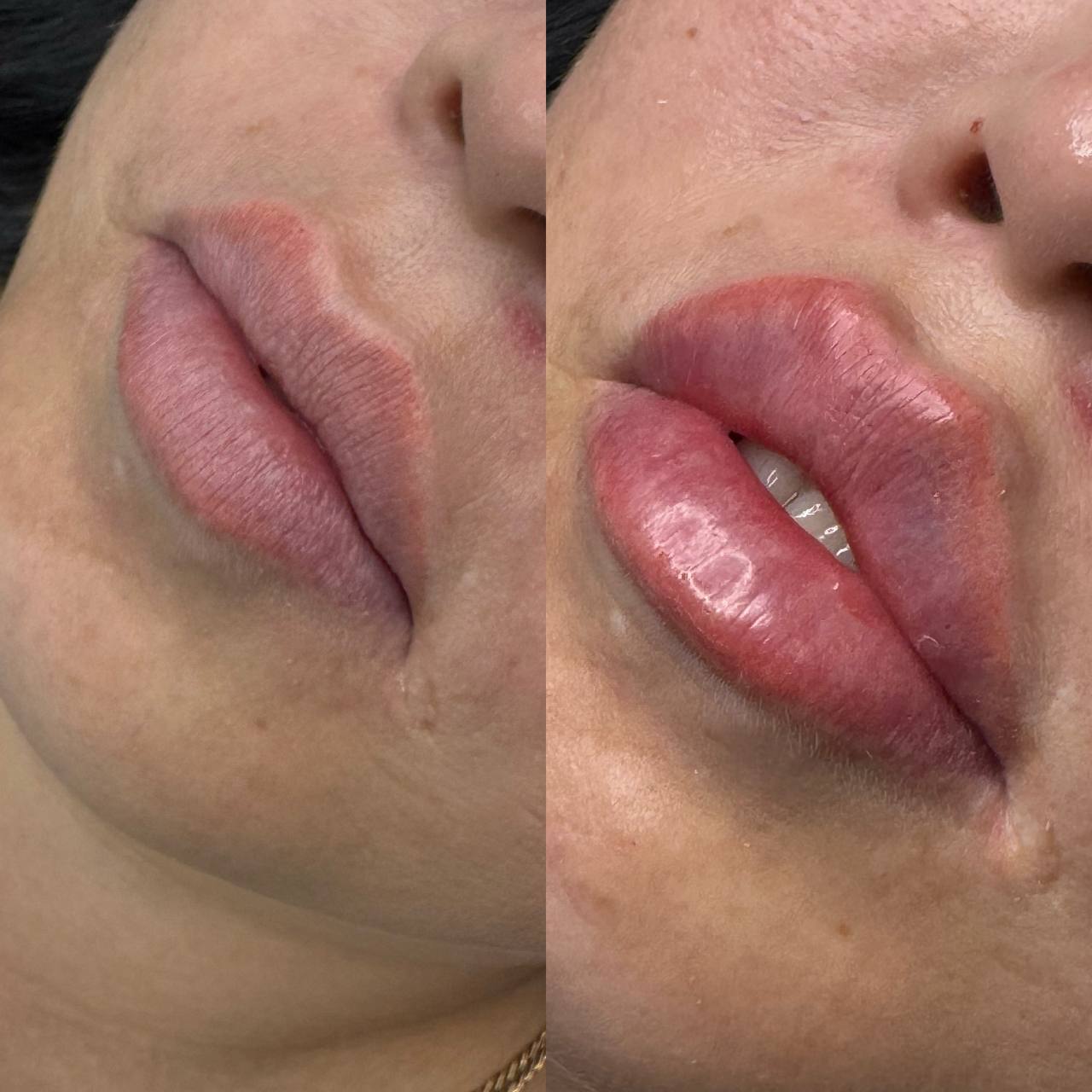 Идеальные губы за 7 990 рублей - Красота и здоровье в Краснодар