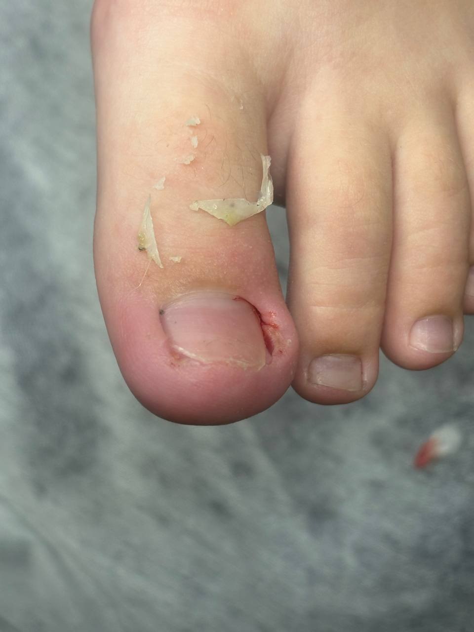 Профессиональная подология для здоровья ног - Услуги в Иркутск