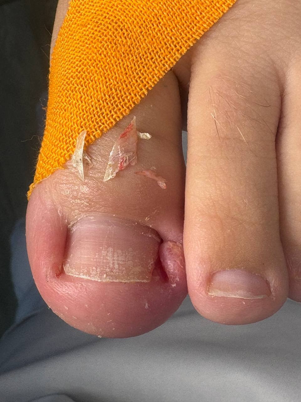 Профессиональная подология для здоровья ног - Услуги в Иркутск - фото 4