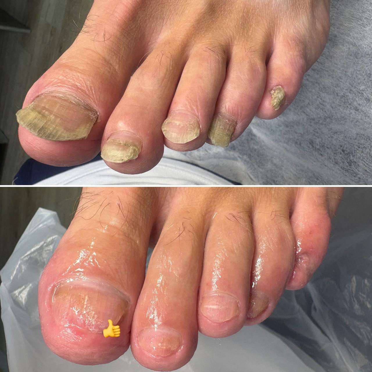 Профессиональная подология для здоровья ног - Услуги в Иркутск - фото 5