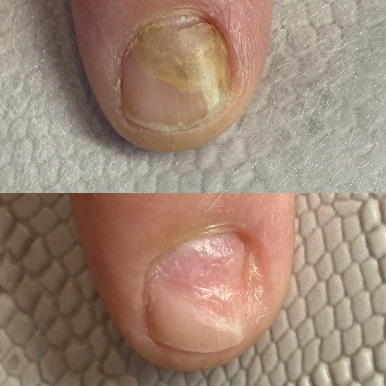 Профессиональная подология для здоровья ног - Услуги в Иркутск - фото 6