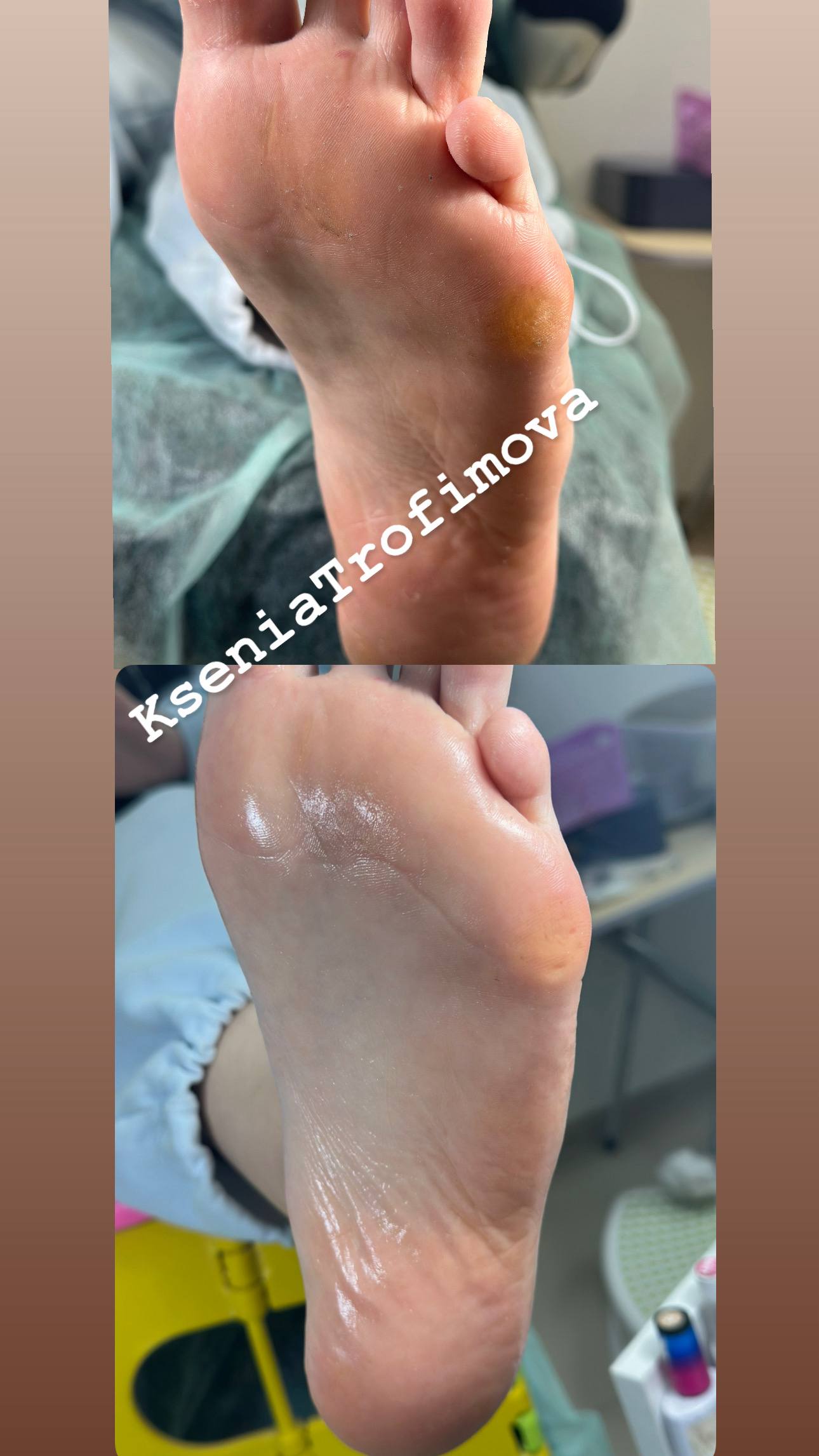 Нужны модели на педикюр и уходы за лицом - Услуги в Астрахань - фото 4