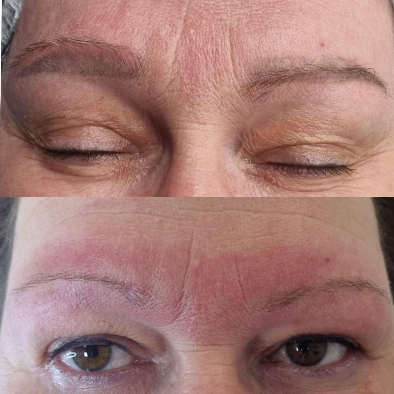 Удаление татуировок и перманентного макияжа - Красота и здоровье в Сургут - фото 3