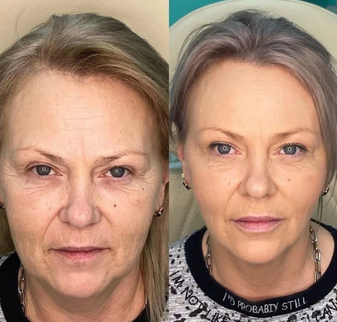 Продажа косметологического аппарата Ultraformer 3 - Готовый бизнес и оборудование в Калининград - фото 3