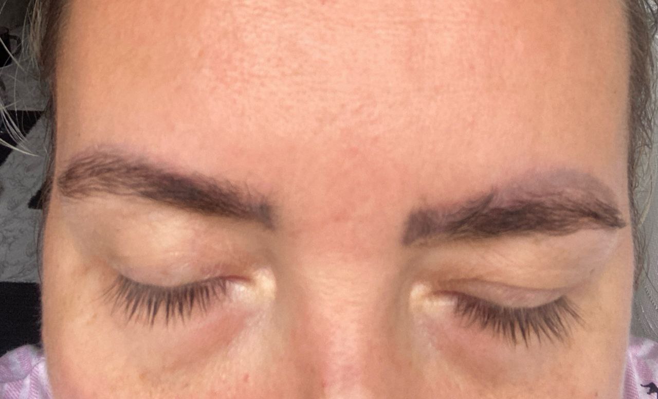 Удаление неудачного перманента или тату - частное объявление в Калининград