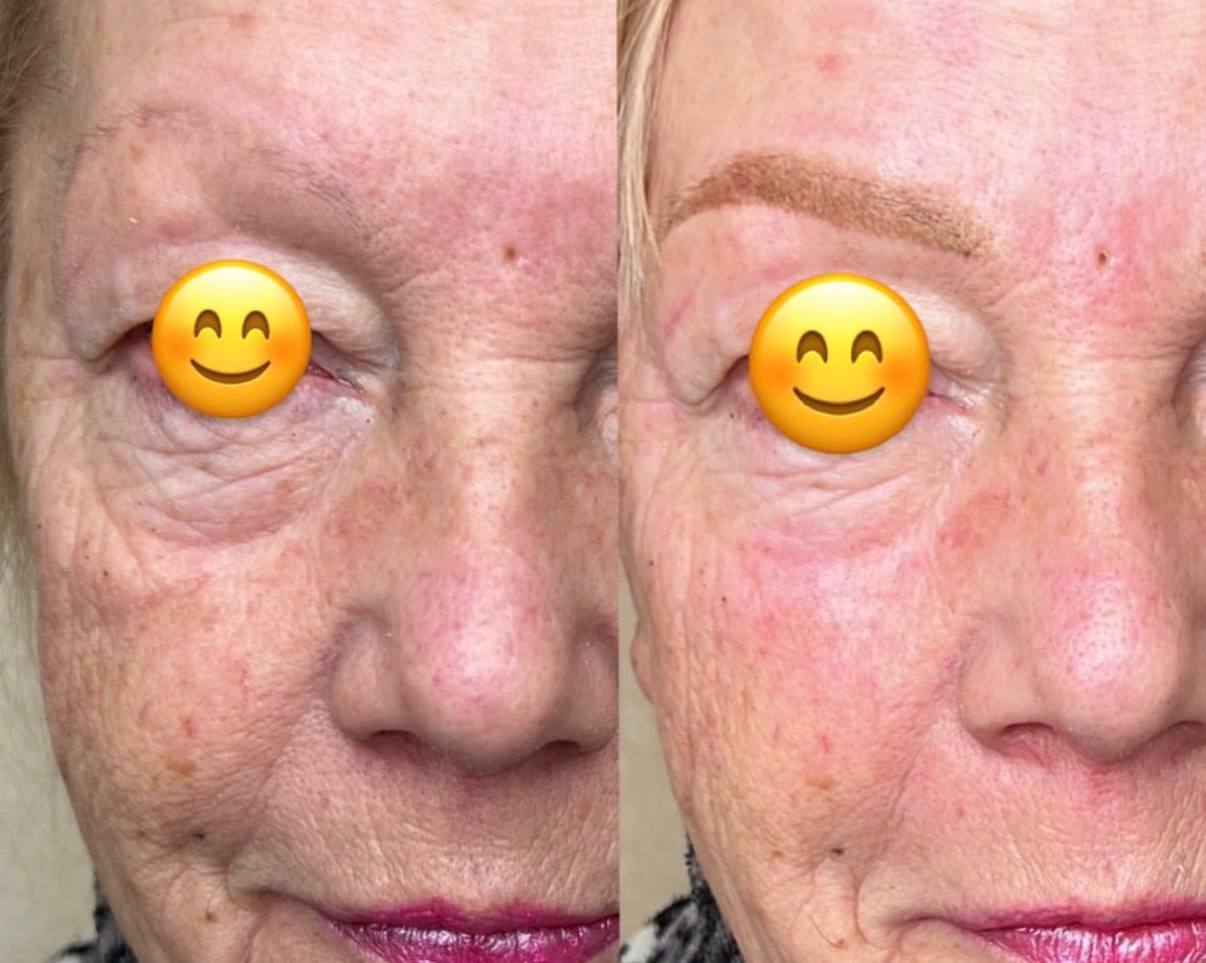 Карбоновый пилинг - акционное предложение - Красота и здоровье в Саратов