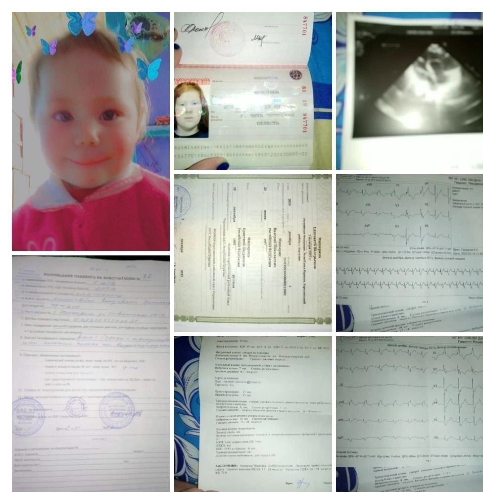 Срочный сбор на лечение ребенка с пороком сердца - частное объявление в Псковская область