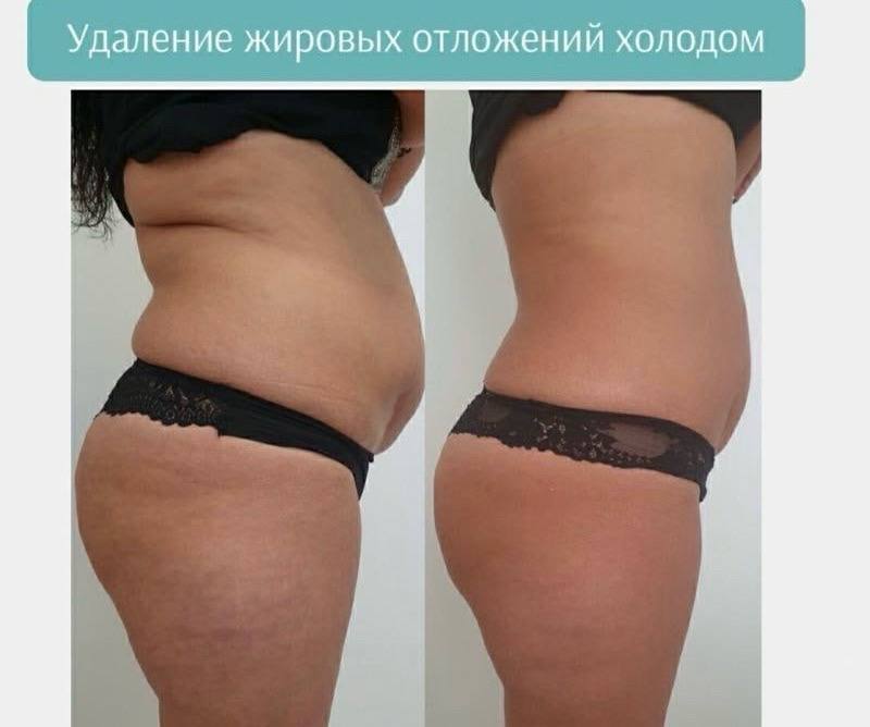 Акция: Подготовим тело к Новому Году - Красота и здоровье в Братск