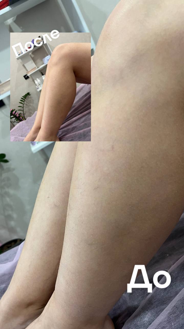 Депиляция на дому - частное объявление в Чебоксары