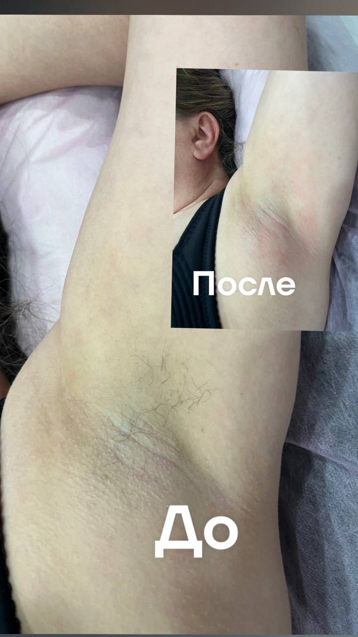 Депиляция на дому - Красота и здоровье в Чебоксары - фото 2