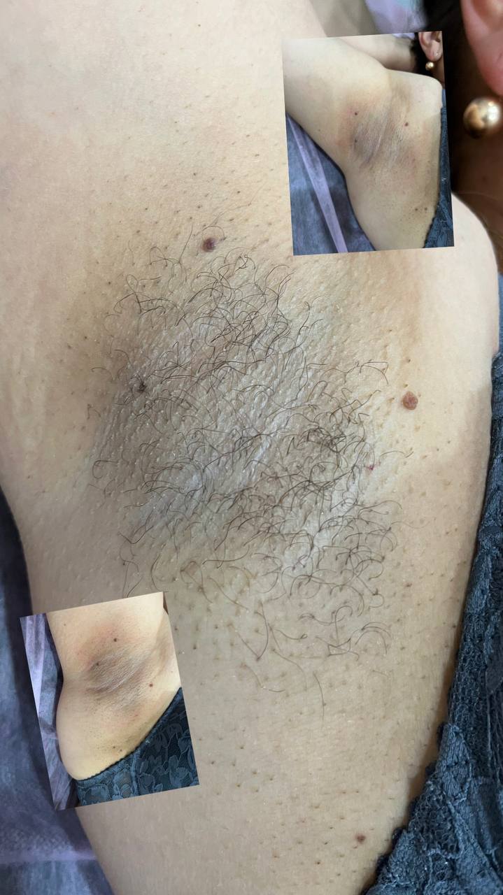 Депиляция на дому - Красота и здоровье в Чебоксары - фото 3