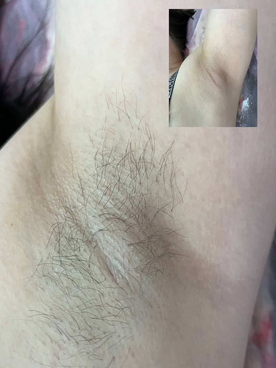 Депиляция на дому - Красота и здоровье в Чебоксары