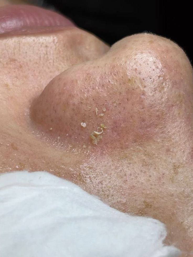 Чистота + Сияние = Идеальная кожа - Красота и здоровье в Чебоксары